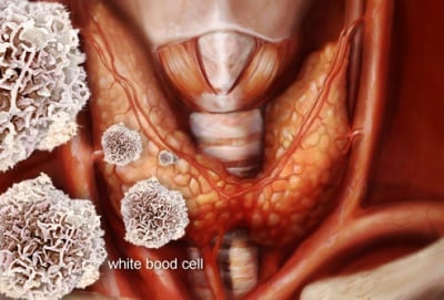 Автоимунен тиреоидит на Хашимото в детската и юношеска възраст