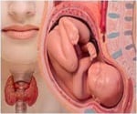 Бременност и отклонения във функцията на щитовидната жлеза